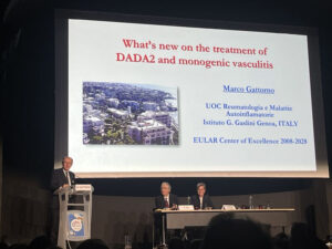 Marco Gattorno from Istituto G. Gaslini presented an update on the treatment of monogenic vasculitides including DADA2